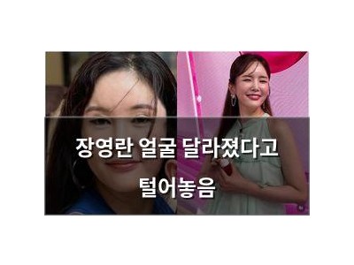 장영란 얼굴 달라졌다고 털어놓음