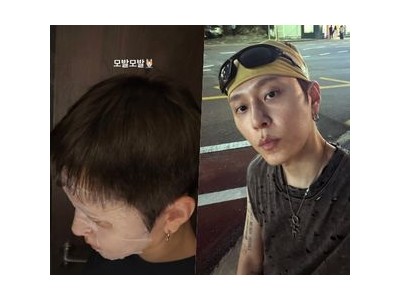 용준형 모발 걱정에 직접 해명하며 팬들과 소통